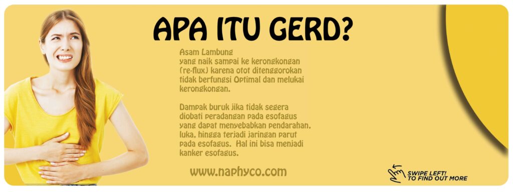 gerd-2-mp